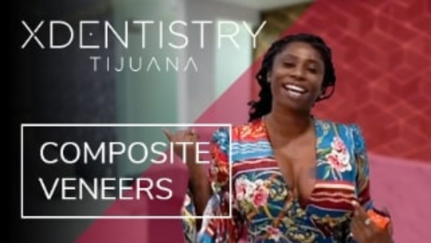 x dentistry compostive veneers patient