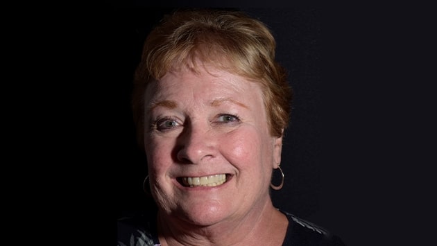 x dentistry inlay onlay patient 01