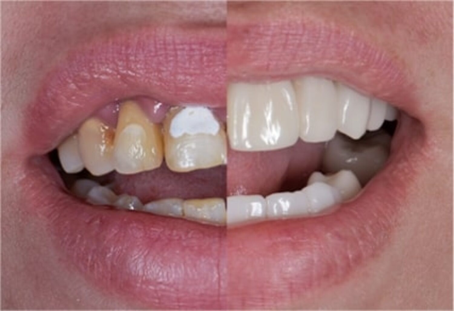 x dentistry prices patient deep cleaning 01