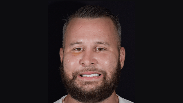 xdentistry all on 4 patient 01