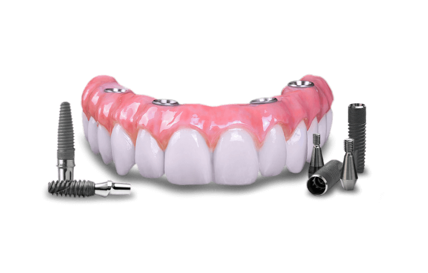 all on 4 copmplete arch