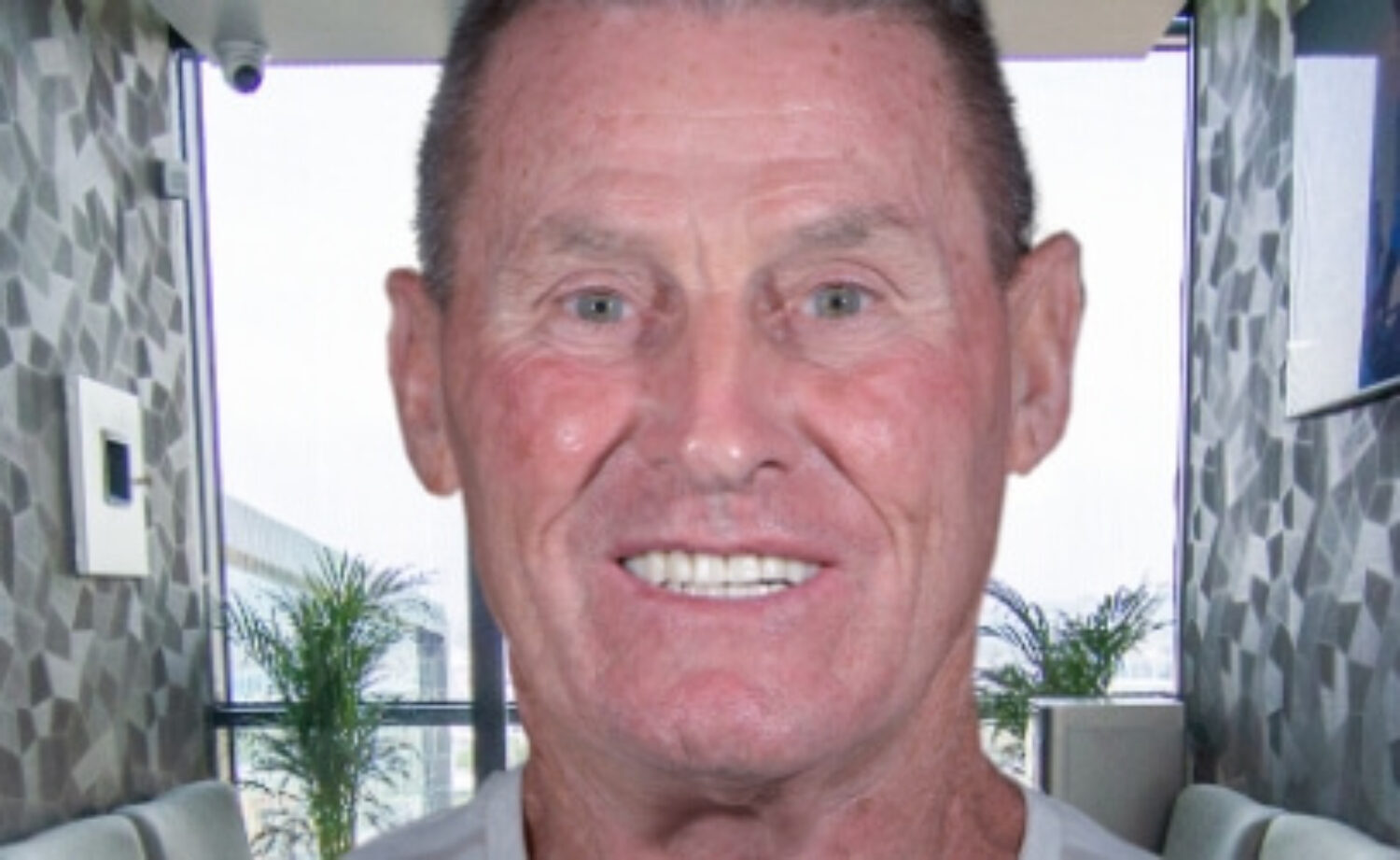 all on 4 patient xdentistry tijuana 03