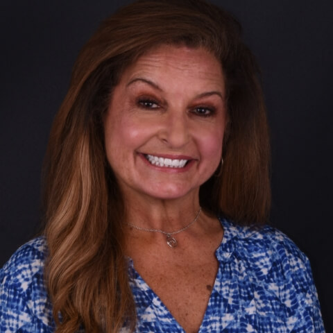 all on 4 patient xdentistry tijuana 04