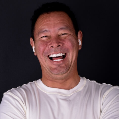 all on 4 patient xdentistry tijuana 05