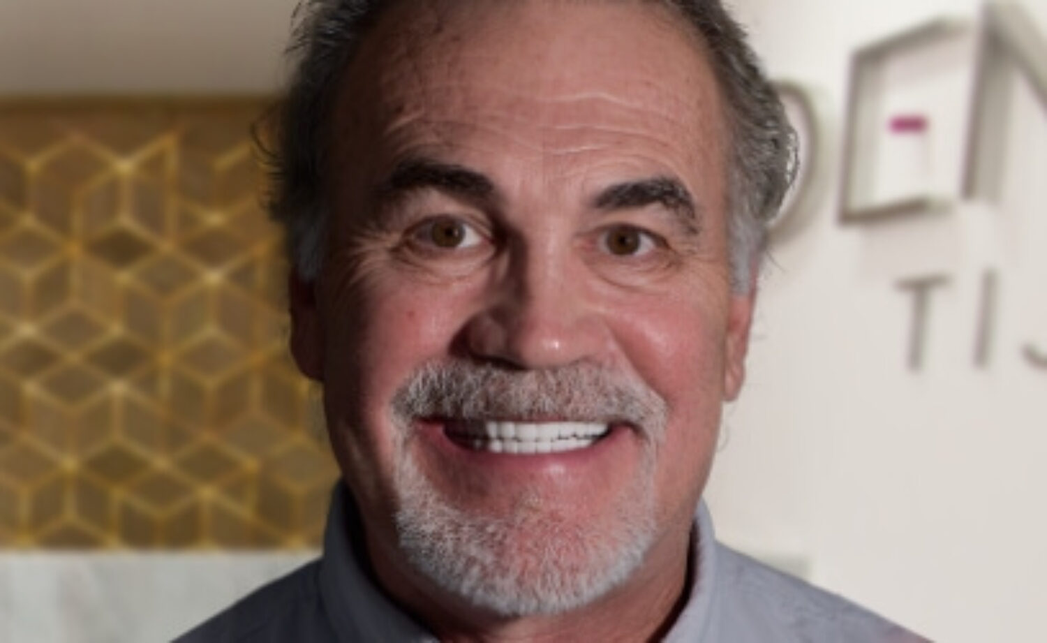 all on 4 patient xdentistry tijuana 08