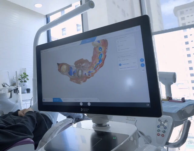 smile design technology tijuana