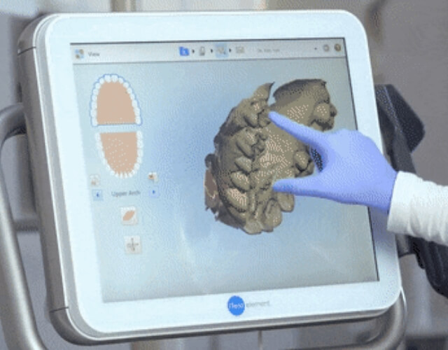 itero tijuana dental technology