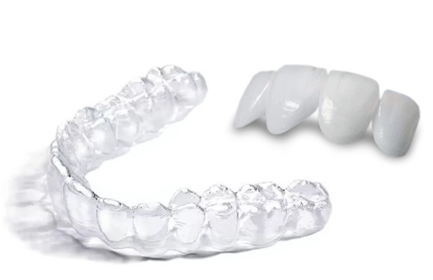 veneers invisalign